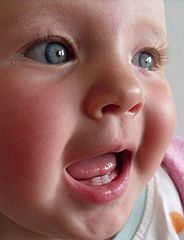 184px-Baby_teeth_in_human_infant