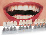 shades of tooth crowns