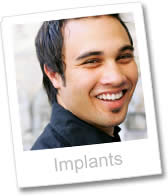 dental implants abroad are cheaper