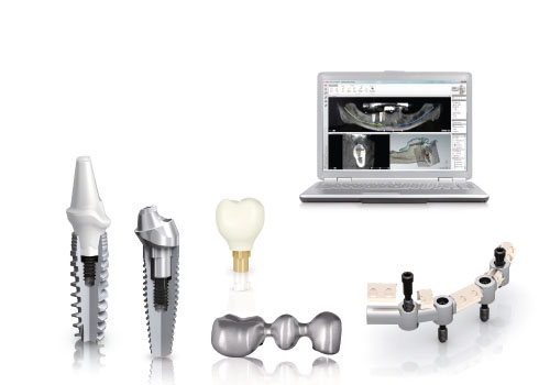 all dental implants prices