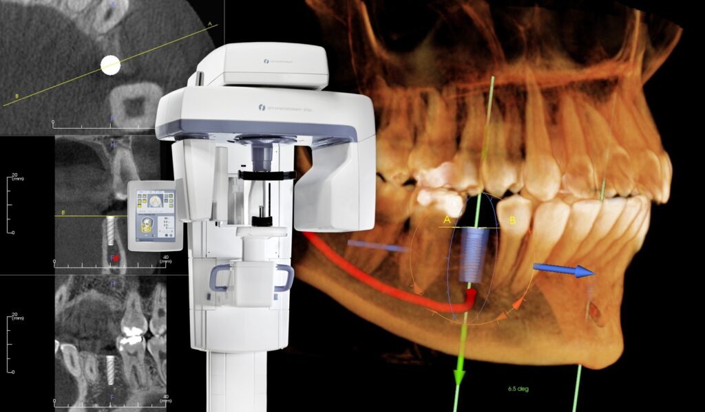 dental holiday cr scanner