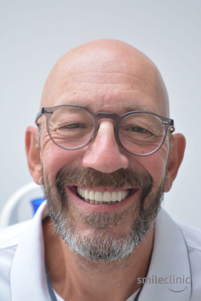 Lawrence is happy AFTER the treatment with Dental Holiday