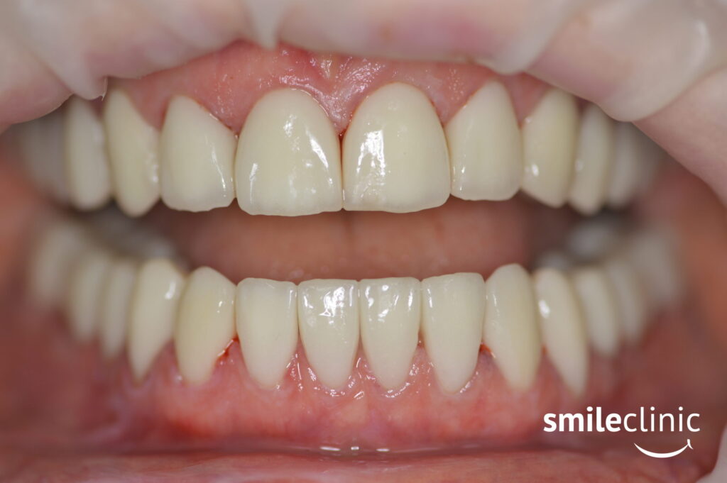 Oxana´s teeth AFTER the treatment